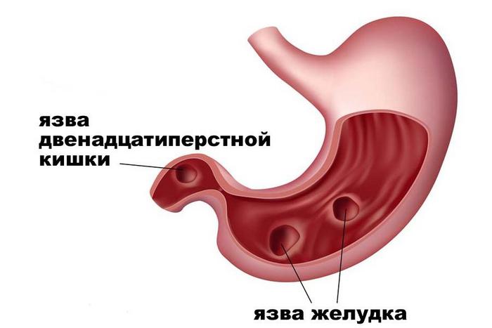 Толстые сырники из творога рецепты