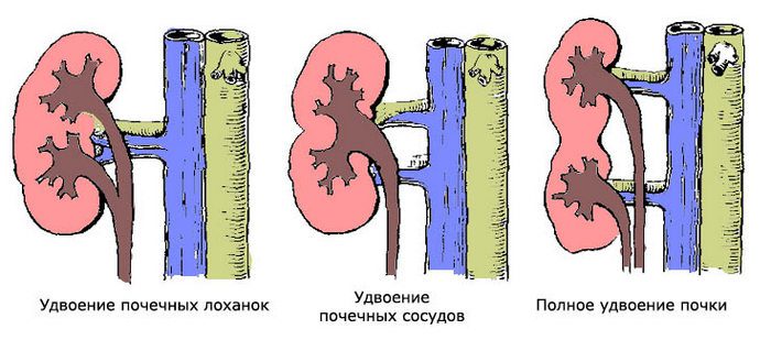 Где находятся почки фото