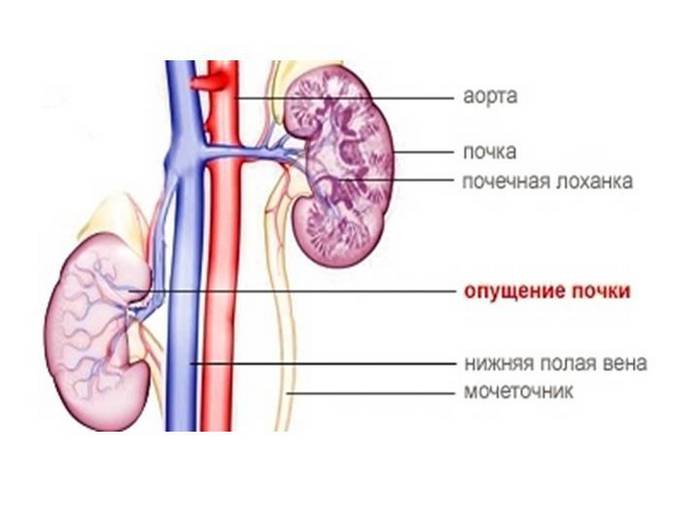 как поднять почку