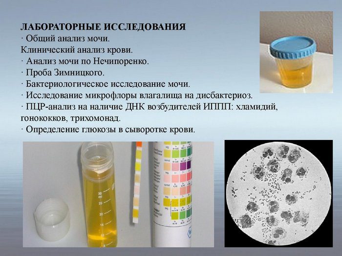 повышенное содержание эритроцитов в моче