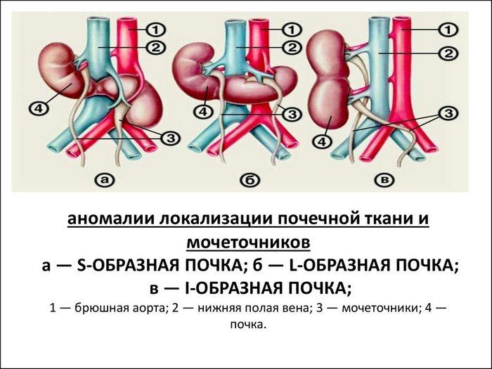 Узи почек картинка