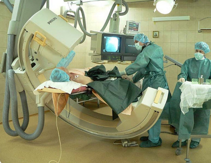 Ангиография почек: почечных сосудов и артерий