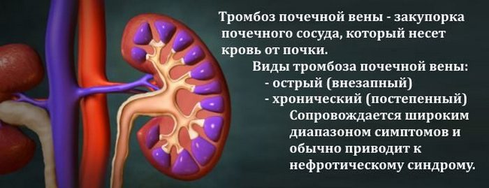 Такая патология характеризуется тромбированием артерии мочевыделительного органа синтопия правой почки